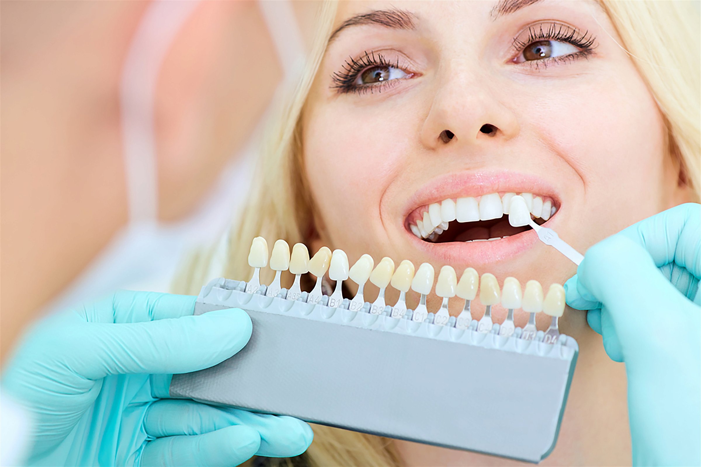 teeth whitening an easy way to transform your smile